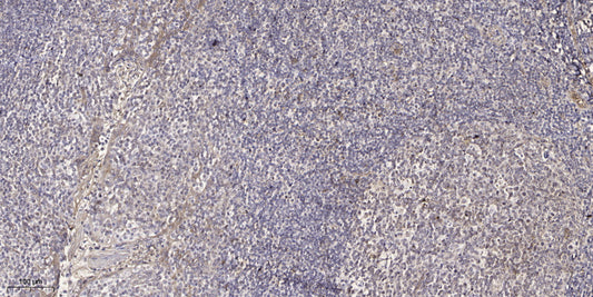 SH3TC2 Rabbit Polyclonal Antibody