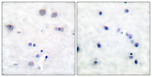 Shc Rabbit Polyclonal Antibody