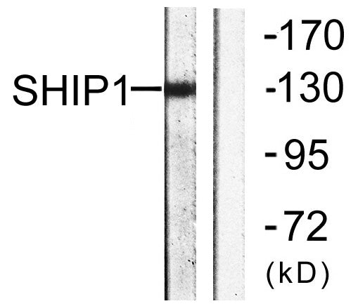SHIP-1 Rabbit Polyclonal Antibody