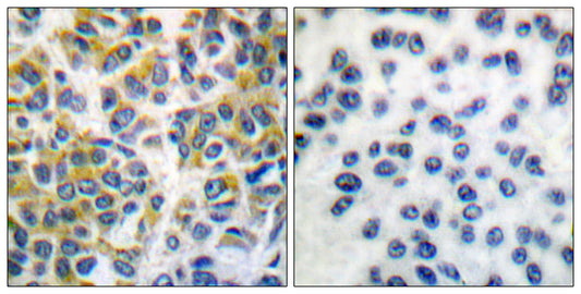 SH-PTP1 Rabbit Polyclonal Antibody