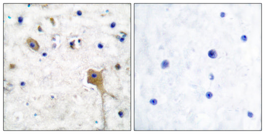 SH-PTP2 Rabbit Polyclonal Antibody