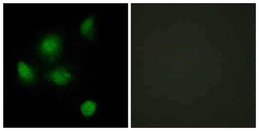 Sin3B Rabbit Polyclonal Antibody
