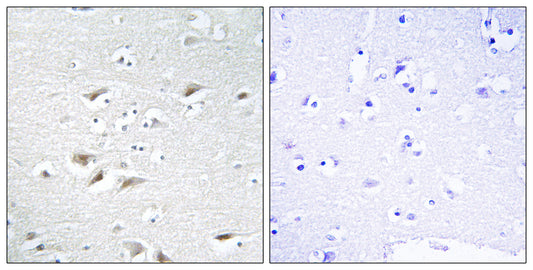 SIP1 Rabbit Polyclonal Antibody