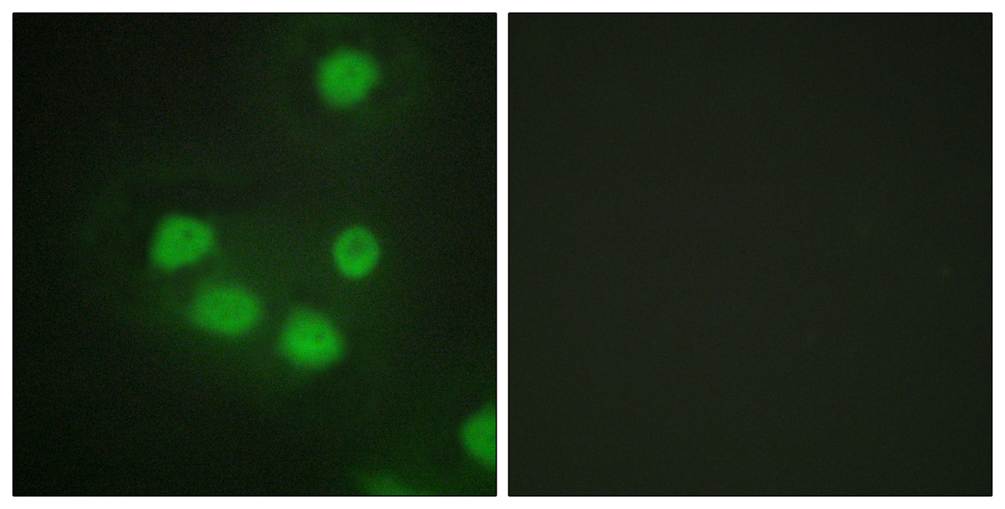 Six3/6 Rabbit Polyclonal Antibody
