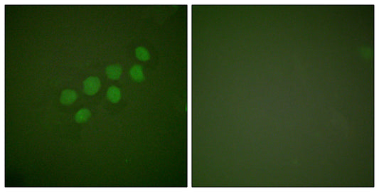 Skp2 p45 Rabbit Polyclonal Antibody