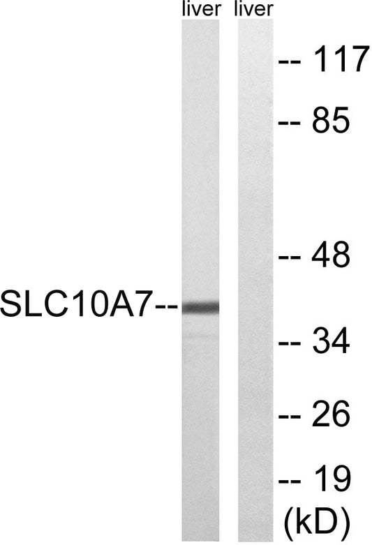 SLC10A7 Rabbit Polyclonal Antibody