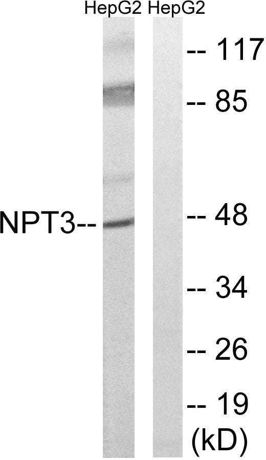 SLC17A2 Rabbit Polyclonal Antibody