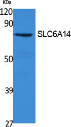 SLC6A14 Rabbit Polyclonal Antibody