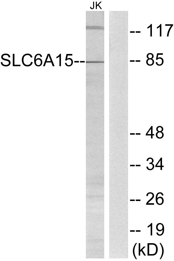 SLC6A15 Rabbit Polyclonal Antibody
