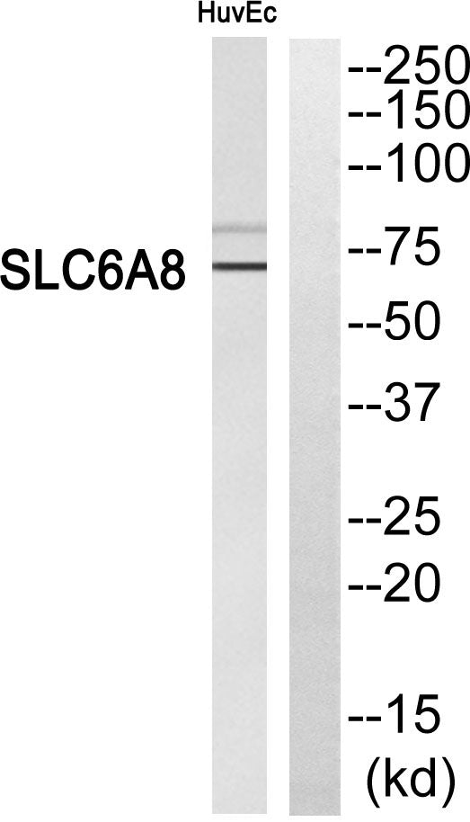 SLC6A8 Rabbit Polyclonal Antibody