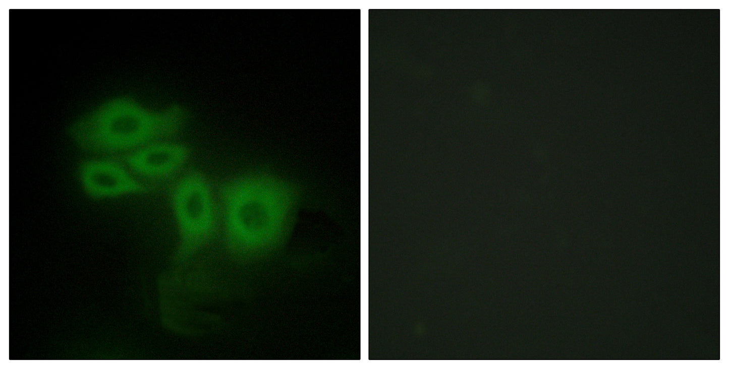 SLK Rabbit Polyclonal Antibody