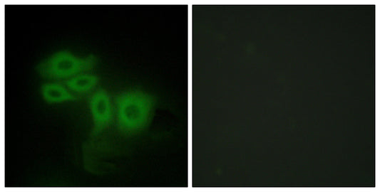 SLK Rabbit Polyclonal Antibody