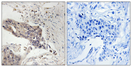 SLP-76 Rabbit Polyclonal Antibody