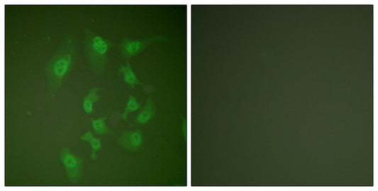 Smad2 Rabbit Polyclonal Antibody
