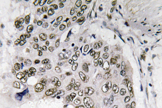 Smad6 Rabbit Polyclonal Antibody
