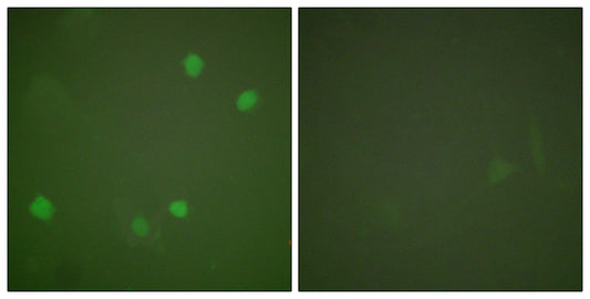 SMAP45 Rabbit Polyclonal Antibody