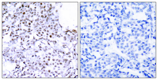 SMC1 Rabbit Polyclonal Antibody