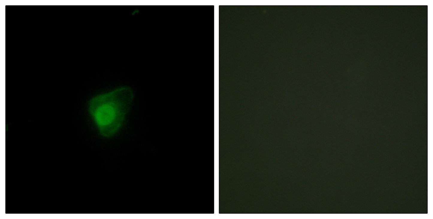 SMG7 Rabbit Polyclonal Antibody