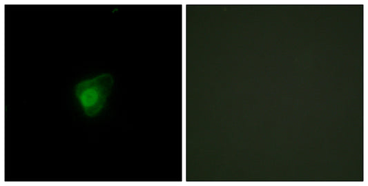 SMG7 Rabbit Polyclonal Antibody