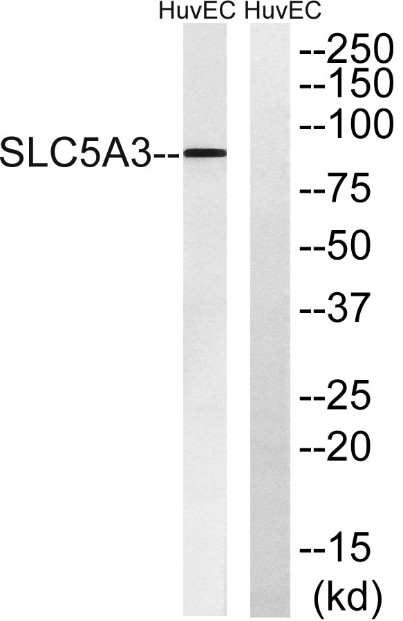 SMIT Rabbit Polyclonal Antibody