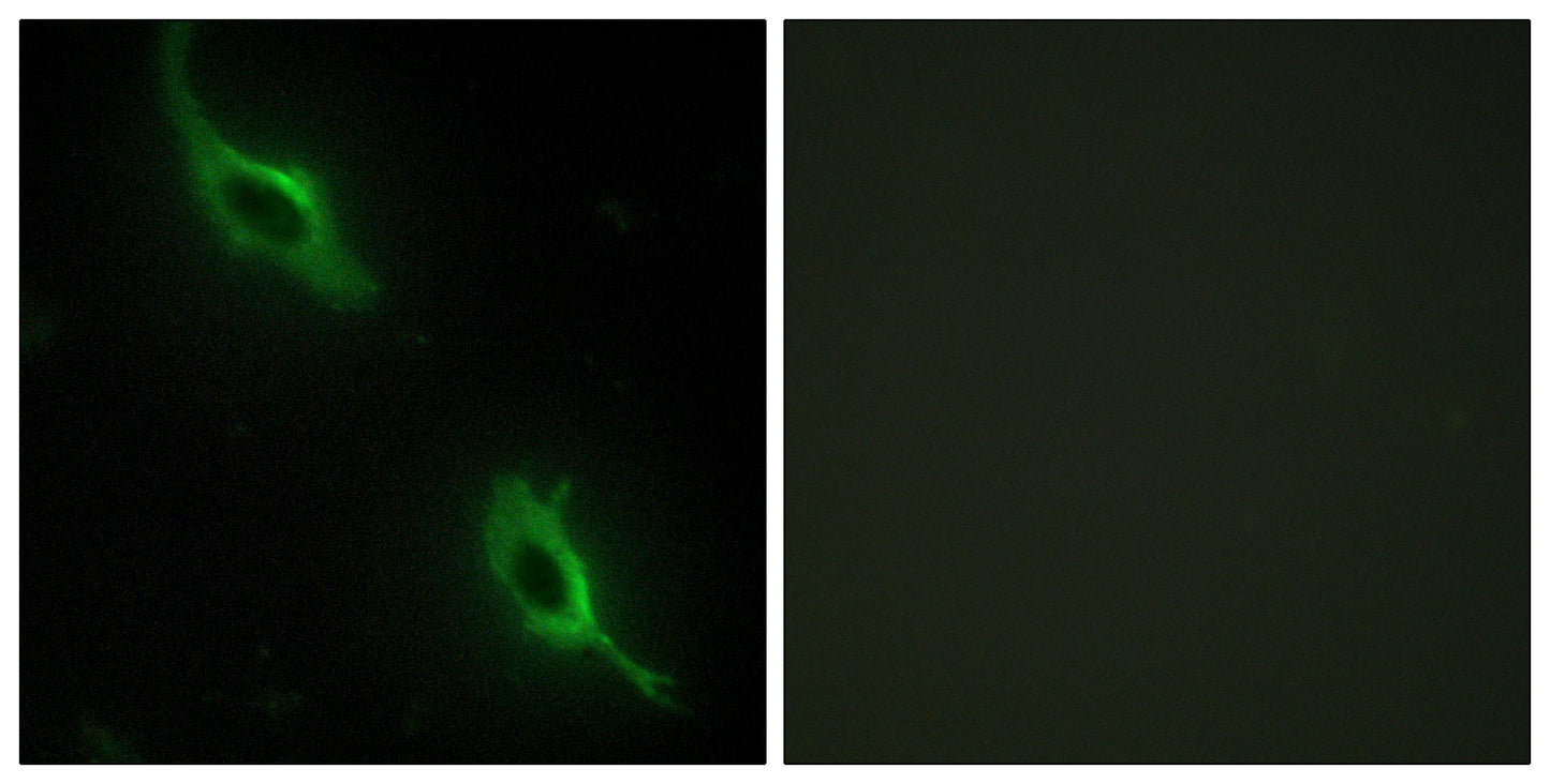 sMtCK Rabbit Polyclonal Antibody