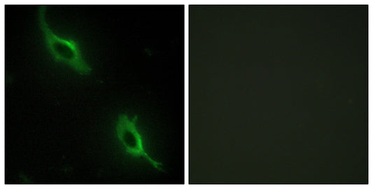 sMtCK Rabbit Polyclonal Antibody