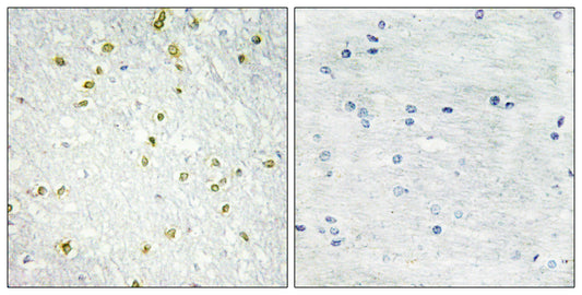 SNAPC 19 Rabbit Polyclonal Antibody