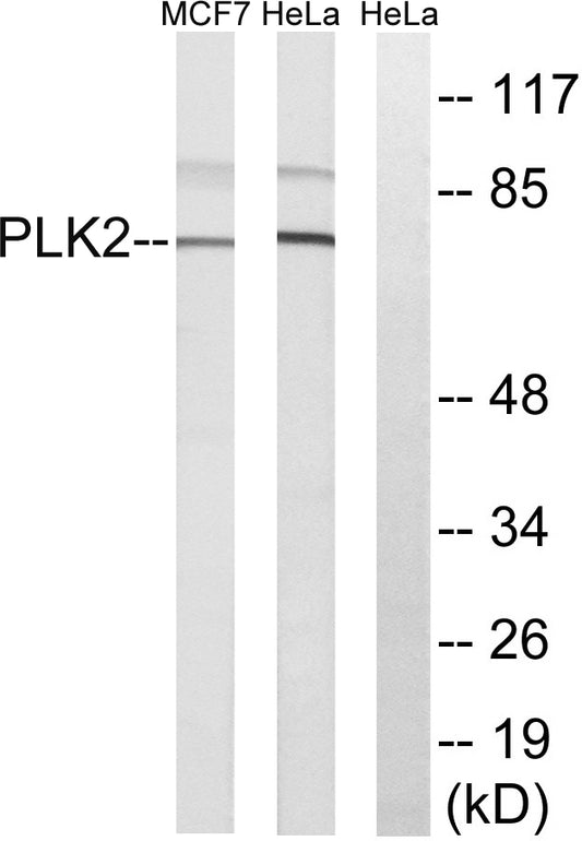 Snk Rabbit Polyclonal Antibody