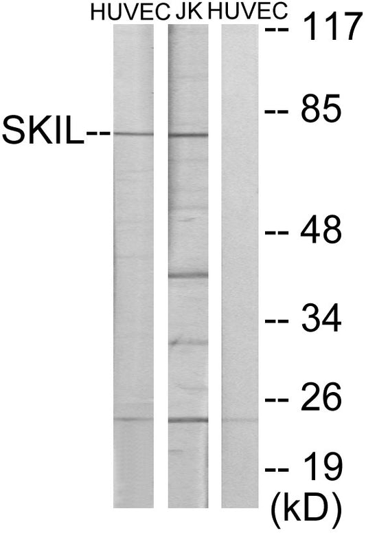 SnoN Rabbit Polyclonal Antibody