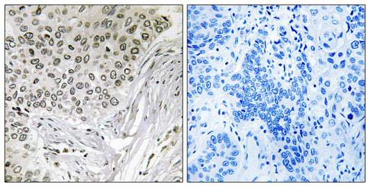 Snrp116 Rabbit Polyclonal Antibody
