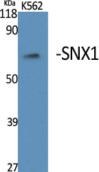 SNX1 Rabbit Polyclonal Antibody