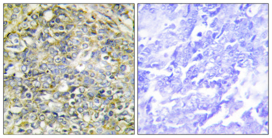 Socius Rabbit Polyclonal Antibody