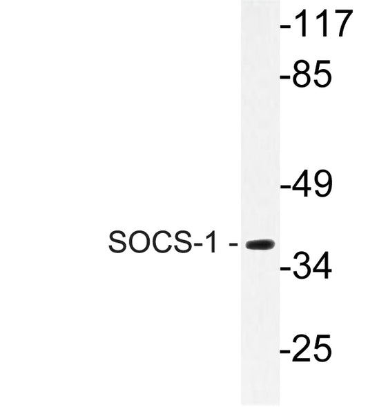 SOCS-1 Rabbit Polyclonal Antibody