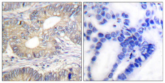 Somatostatin Rabbit Polyclonal Antibody