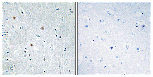 Sox-12 Rabbit Polyclonal Antibody