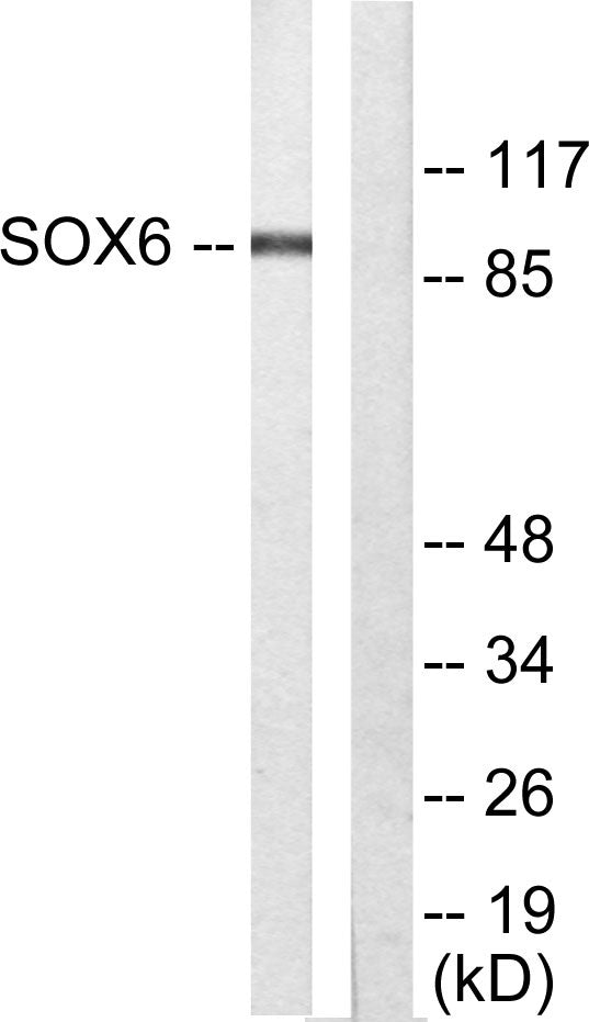 Sox-6 Rabbit Polyclonal Antibody