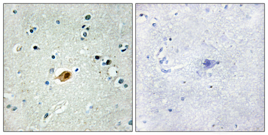 Sox-8/9/17/18 Rabbit Polyclonal Antibody