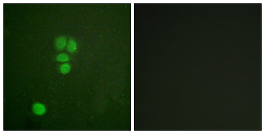Sox-9 Rabbit Polyclonal Antibody