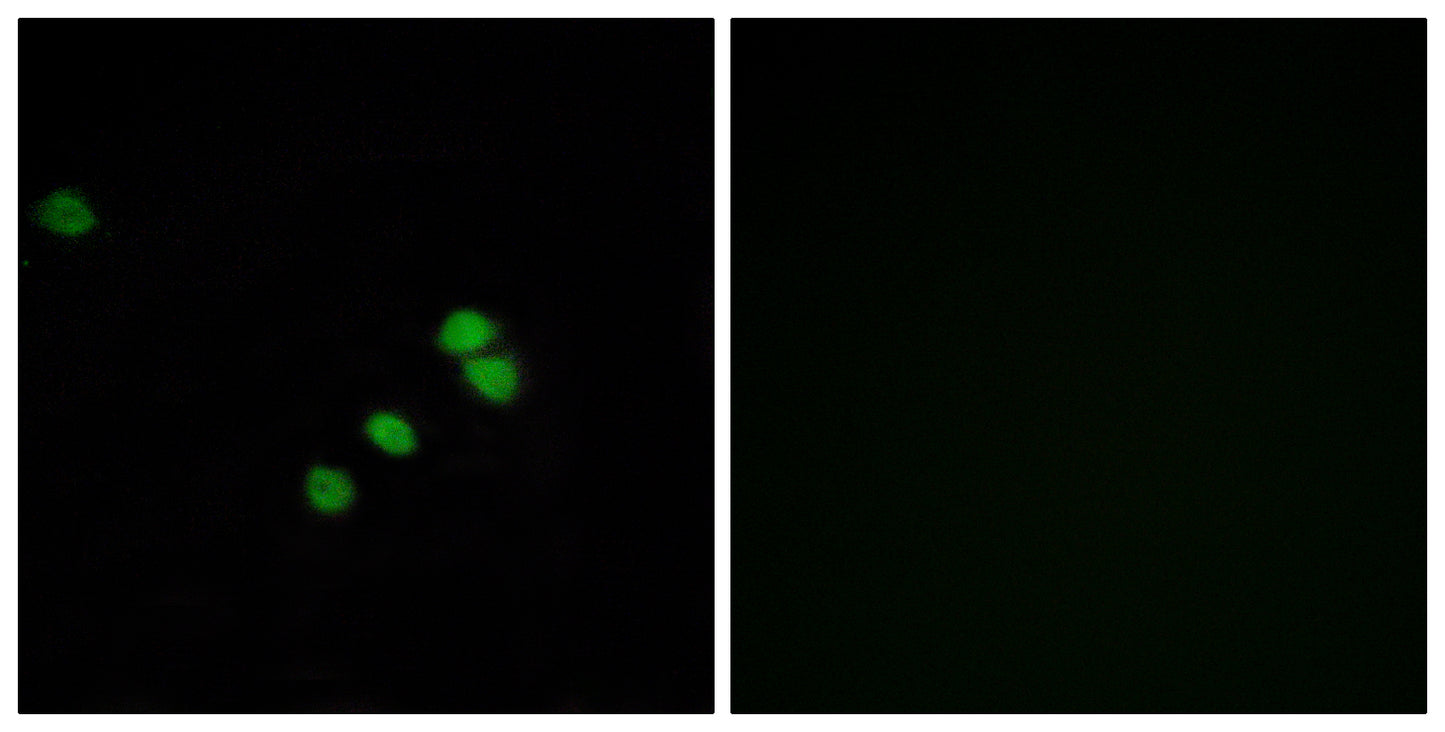 Sp1 Rabbit Polyclonal Antibody