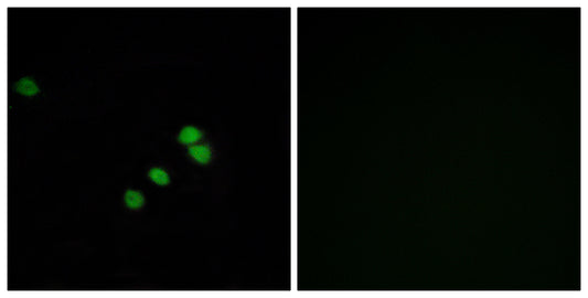 Sp1 Rabbit Polyclonal Antibody