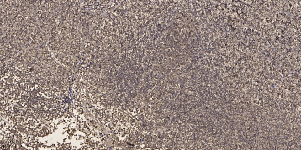SP-100 Rabbit Polyclonal Antibody