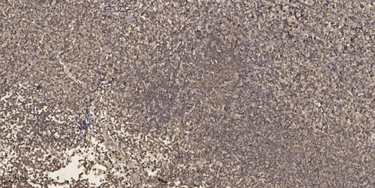 SP-100 Rabbit Polyclonal Antibody