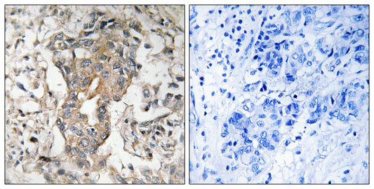 SphK2 Rabbit Polyclonal Antibody