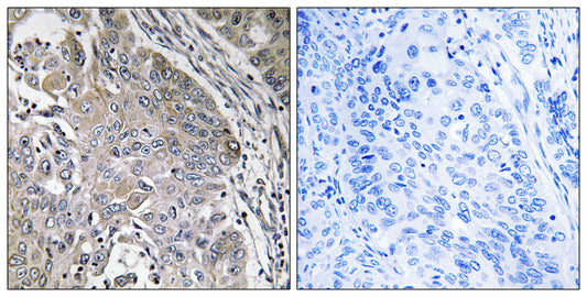 SPINK6 Rabbit Polyclonal Antibody