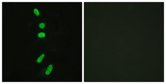 Splicing factor 1 Rabbit Polyclonal Antibody