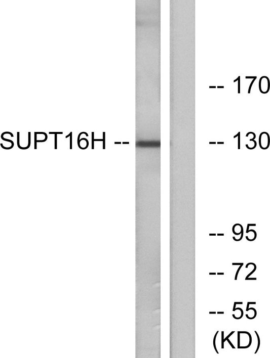 SPT16 Rabbit Polyclonal Antibody