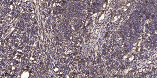 SPTN4 Rabbit Polyclonal Antibody