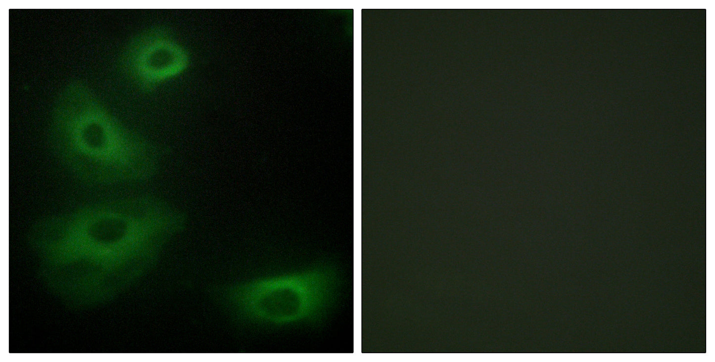 SR-1B Rabbit Polyclonal Antibody