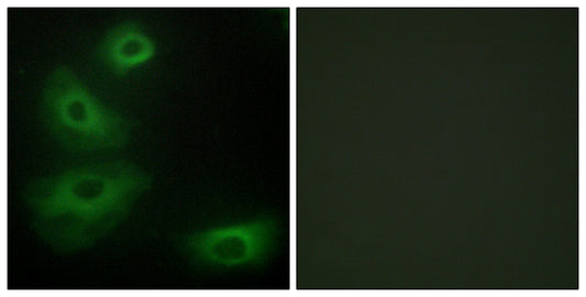 SR-1B Rabbit Polyclonal Antibody