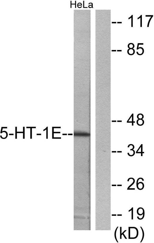 SR-1E Rabbit Polyclonal Antibody